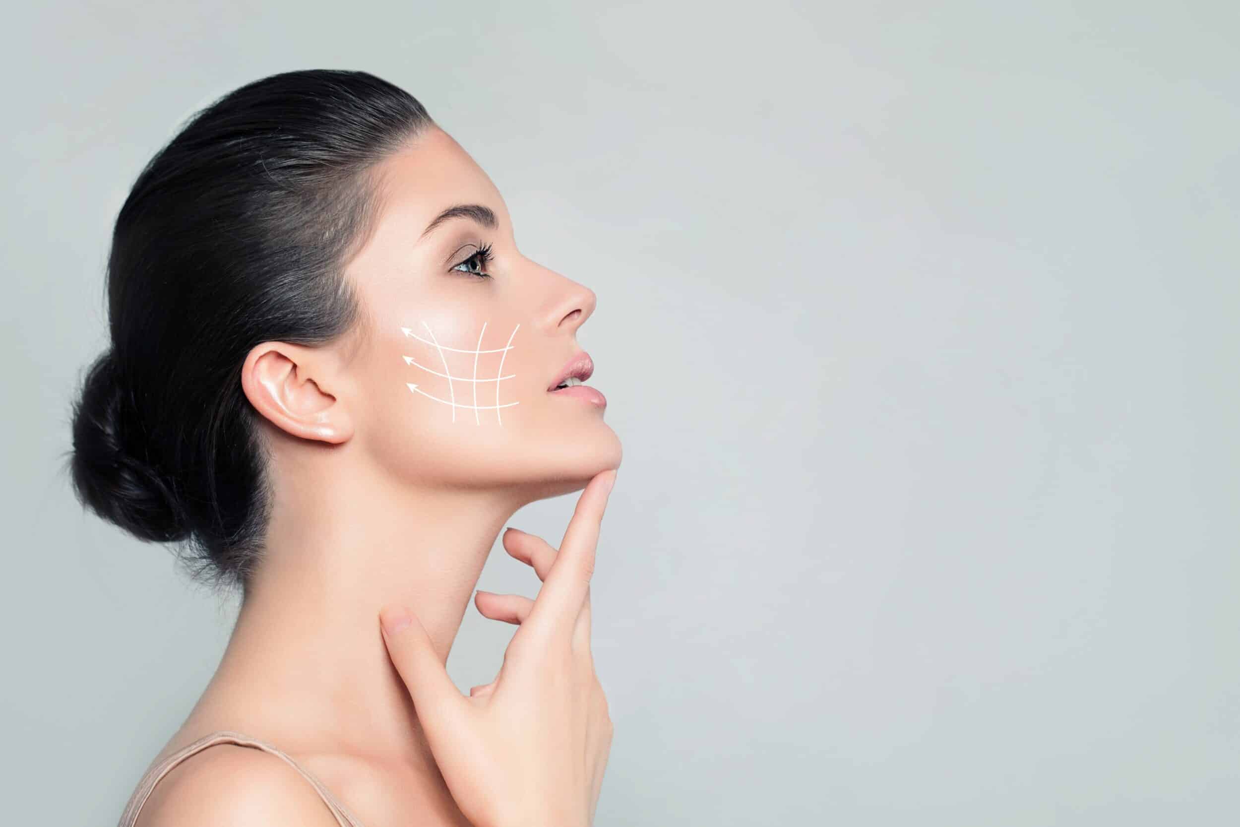 Side profile of woman with slim, defined neck and chin from Kybella in Whittier, CA
